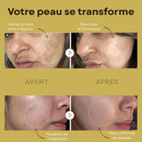 Serum complexe PDRN Peptide 30ml (PROMOTION) - skinplus