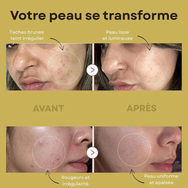 Serum complexe PDRN Peptide 30ml (PROMOTION) - skinplus